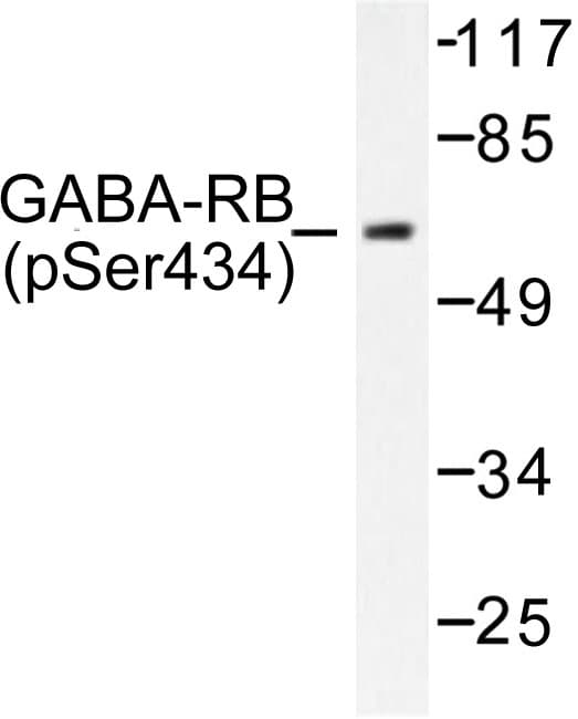 GABRB1 Antibody (phospho-Ser434)