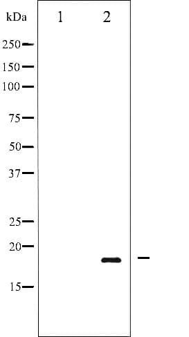 SNCA / Alpha-Synuclein Antibody (phospho-Tyr136)