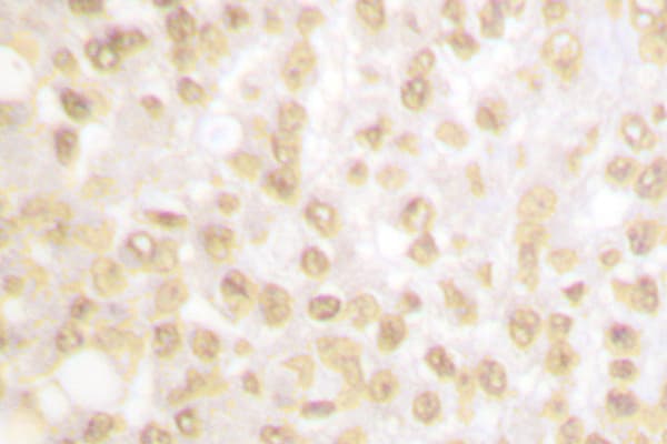 Polyclonal Rabbit anti-Human NKX3-1 Antibody (Leu2, IHC, WB)