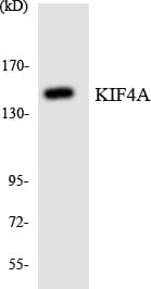 Polyclonal Rabbit anti-Human KIF4A Antibody (aa1160-1209, WB)