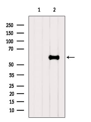 Polyclonal Rabbit anti-Human SLC38A1 / NaT2 Antibody (WB)