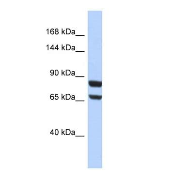 Polyclonal Rabbit anti-Human PR / Progesterone Receptor Antibody (aa51-100, WB)
