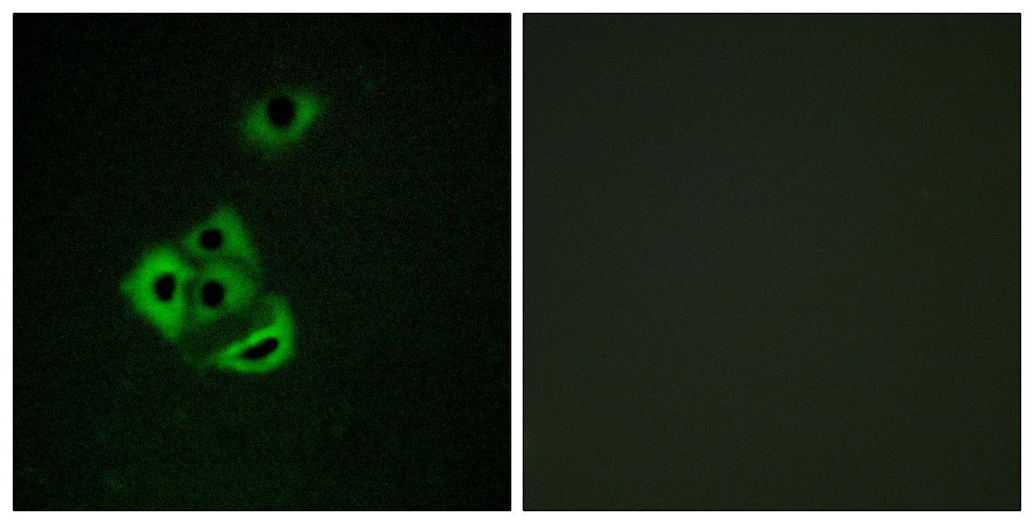 MCL1 / MCL 1 Antibody (phospho-Ser159)