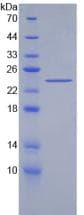 Human ACHE / Acetylcholinesterase Protein (Recombinant His)