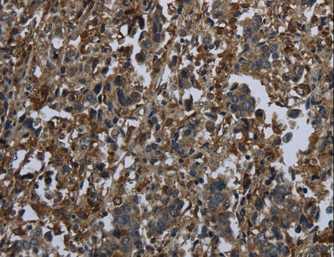 GLUL / Glutamine Synthetase Antibody