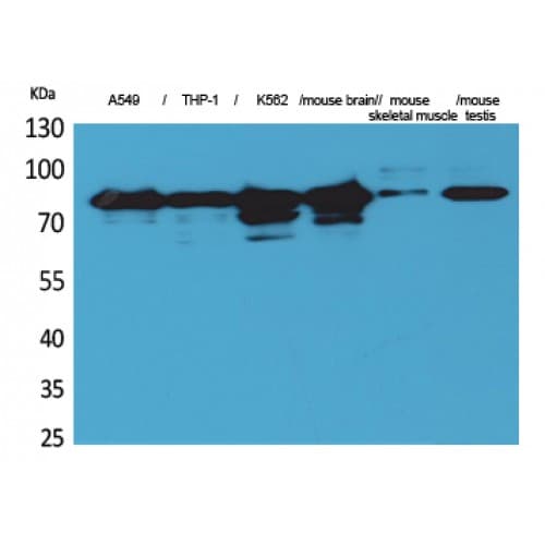 PRKCG / PKC-Gamma Antibody (521-570 aa, Internal)