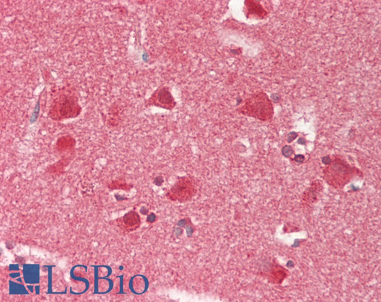 Polyclonal Rabbit anti-Human RBFOX1 / A2BP1 Antibody (C-Terminus, IHC, WB)