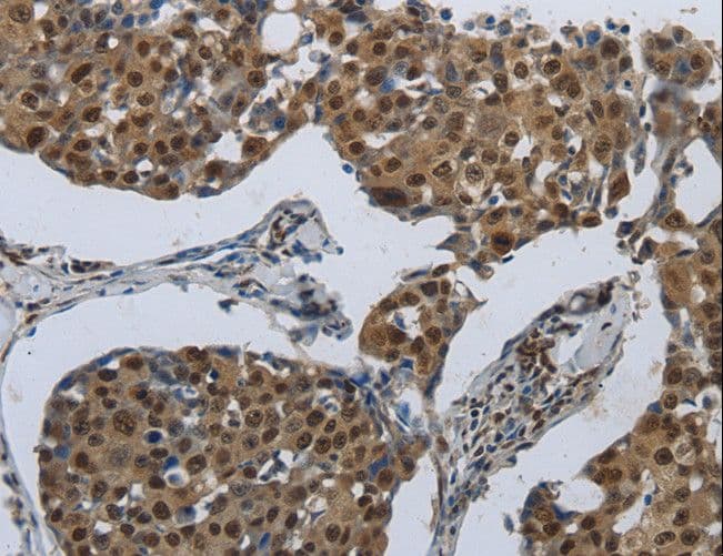 PRKAR1B Antibody