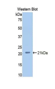 Properdin / CFP Antibody (aa54-217, Biotin)