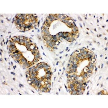 ITGA2B / CD41 Antibody (aa677-711)
