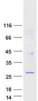 Human RWDD1 Protein (Recombinant Myc-DDK (Flag))