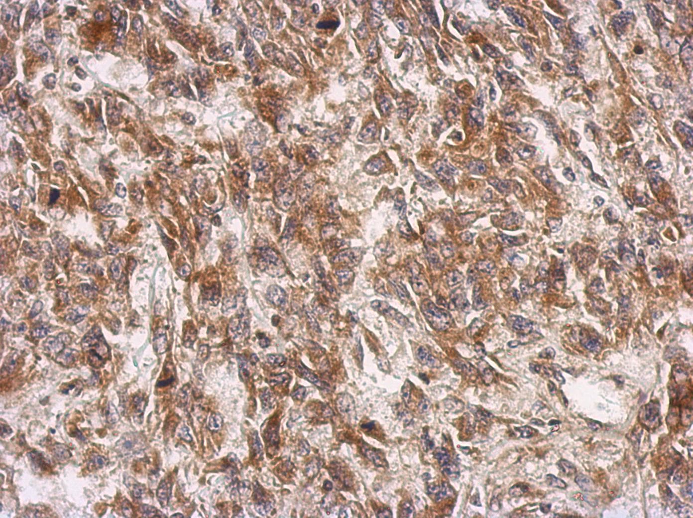 MMP2 Antibody (aa193-575)