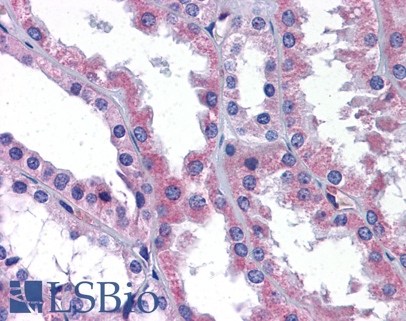 IHC-plus™ AKT3 Antibody (aa119-136)