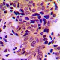 ATF4 Antibody (phospho-Ser245)