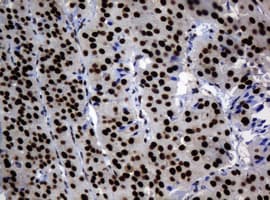 ZSCAN18 / ZNF447 Antibody (clone OTI4D10, Carrier-free)