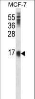SCA2 / LY6E Antibody (aa41-70)