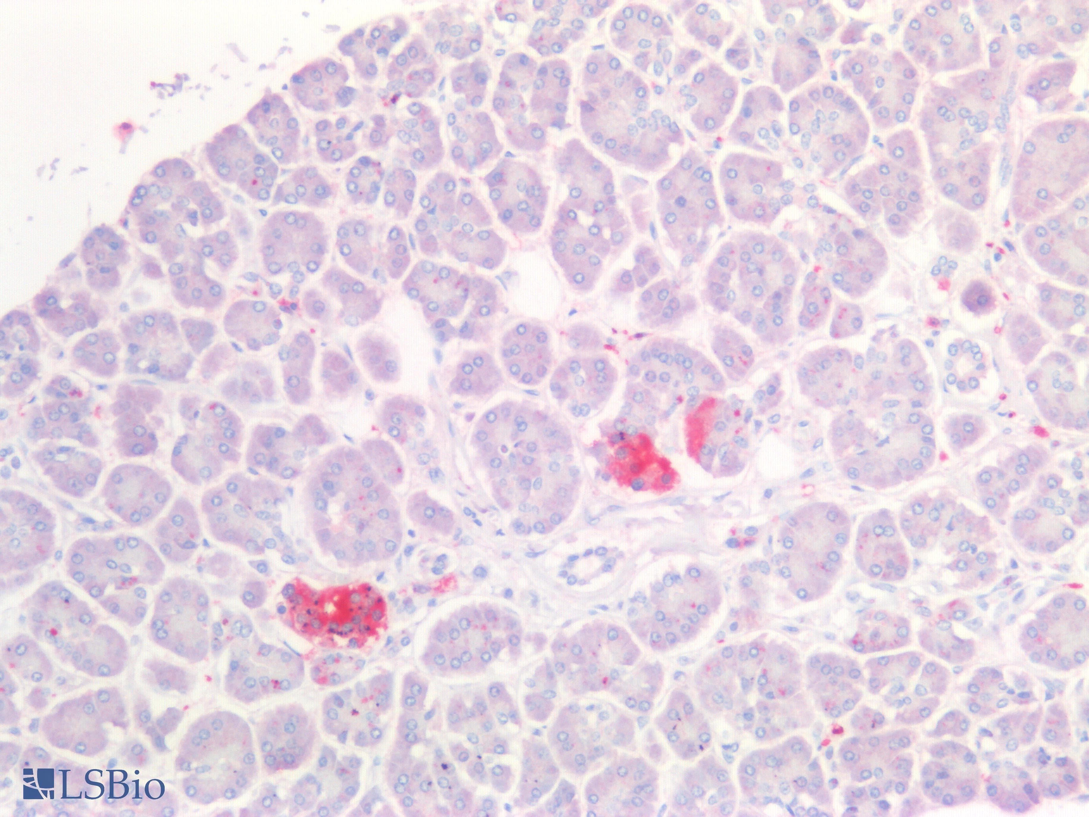 IHC-plus™ Polyclonal Goat anti-Human UCHL1 / PGP9.5 Antibody (aa58-68, IHC, WB)