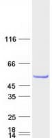 Human TBC1D10C / CARABIN Protein (Recombinant Myc-DDK (Flag))