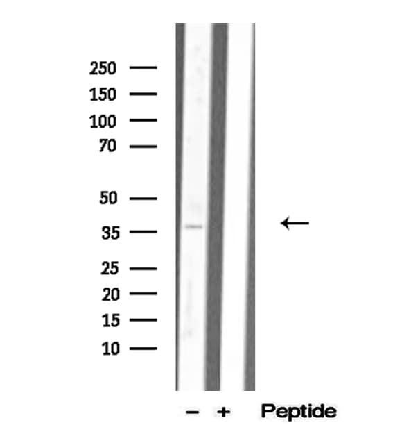 Polyclonal Rabbit anti-Human MDH1 Antibody (IHC, IF, WB)