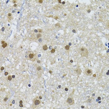 Polyclonal Rabbit anti-Human TP53BP1 / 53BP1 Antibody (IHC, IF, WB)