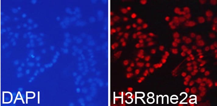 Histone H3 Antibody (Asym-Di-Methyl-Arg8)