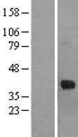 Human CTSK / Cathepsin K Protein (Over-Expression Lysate Myc-DDK (Flag))