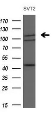 PDGFRA / PDGFR Alpha Antibody (aa789-1089, clone OTI1A11, Carrier-free)