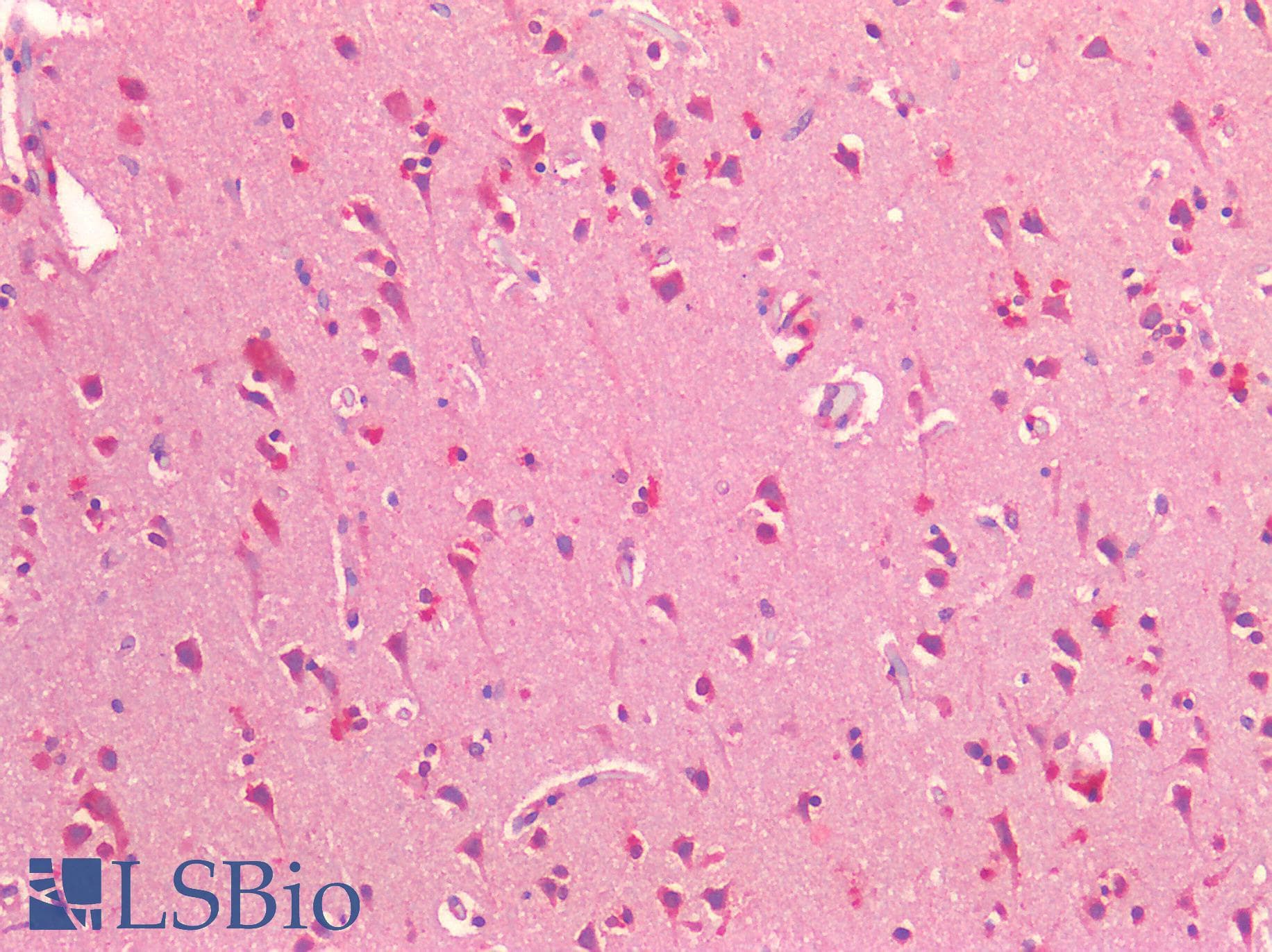 IHC-plus™ NOTCH2 Antibody