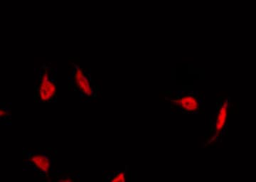 Polyclonal Rabbit anti-Human PPARG / PPAR Gamma Antibody (phospho-Ser112, IHC, IF, WB)