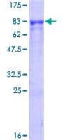 Human RICK / RIP2 Protein (Recombinant GST)