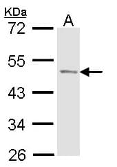 ACPP / PAP Antibody (aa177-362)