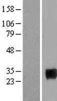 SIX6 Protein (Over-Expression Lysate Myc-DDK (Flag))