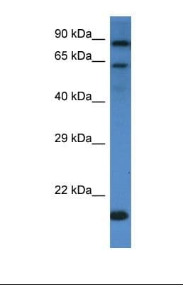 Polyclonal Rabbit anti-Human IL4R / CD124 Antibody (aa656-705, WB)