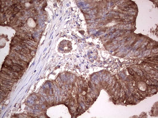 Monoclonal Mouse anti-Human LGALS3 / Galectin 3 Antibody (clone OTI15E4, IHC, WB)