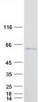 Human EIF5 Protein (Recombinant Myc-DDK (Flag))