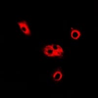 ADSL / Adenylosuccinate Lyase Antibody