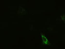 KRT19 / CK19 / Cytokeratin 19 Antibody (clone OTI2F8)