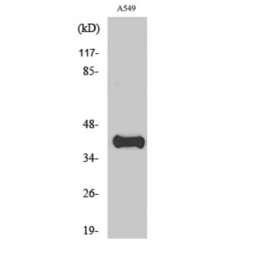 APOL1 / Apolipoprotein L Antibody (230-310 aa, Internal)