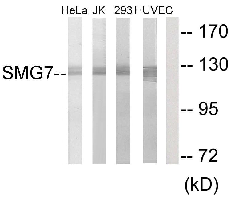 SMG7 Antibody (aa521-570)