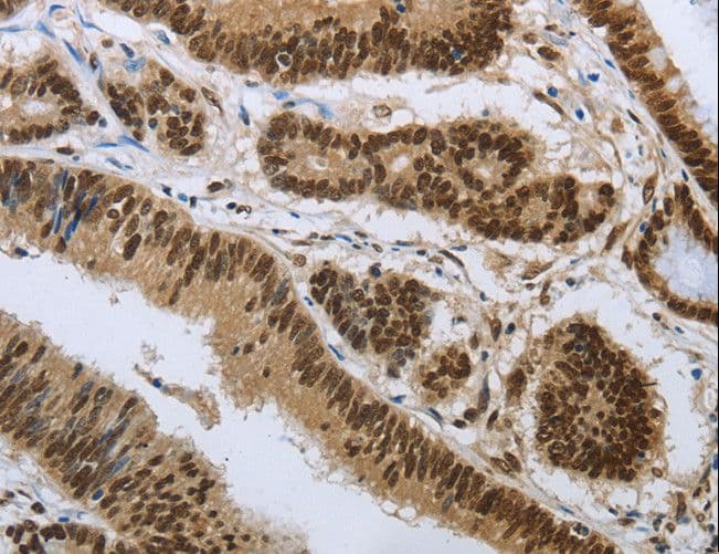 PRMT3 Antibody