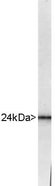 UCHL1 / PGP9.5 Antibody
