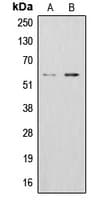 ALDH1B1 Antibody (Internal)