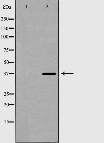 TOR1A / Torsin A Antibody