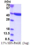 Human DNAJC27 Protein (Recombinant His)