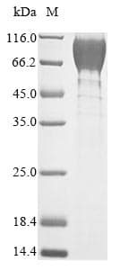 Mouse GUCY2C / Guanylyl Cyclase C Protein (Recombinant 10His, N-terminus + Myc, C-terminus)