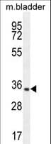 C15orf41 Antibody (aa167-193)