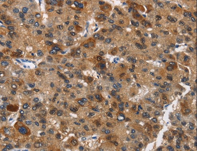 DCC Antibody