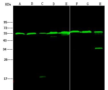 TUBB / Beta Tubulin Antibody (clone 05, Preservative Free)