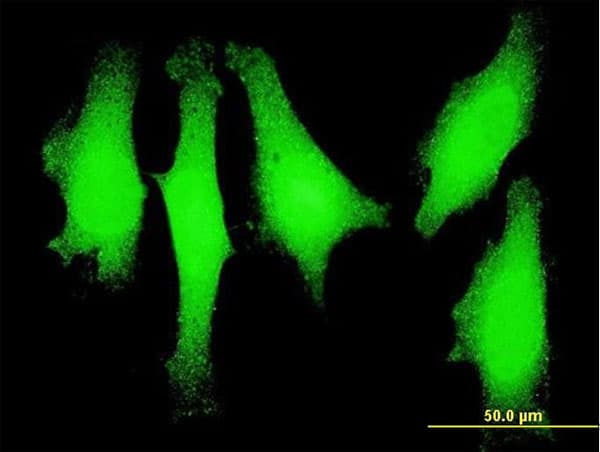 Monoclonal Mouse anti-Human LMO1 Antibody (clone 4F7, IF, WB)