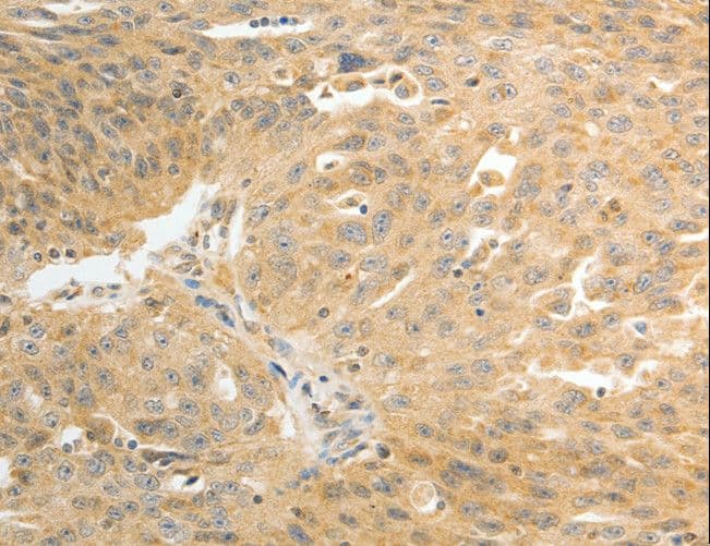DDH / AKR1C1 Antibody